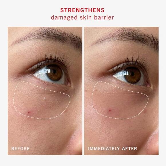 First Aid Beauty-Ultra Repair Rescue Skin Barrier Balm + Mask with Dimethicone - Picture 6 of 7